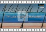 Gel gillette